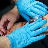 Worker wearing gloves providing first aid to arm wound