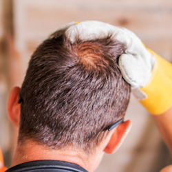 Image of worker showing a head injury