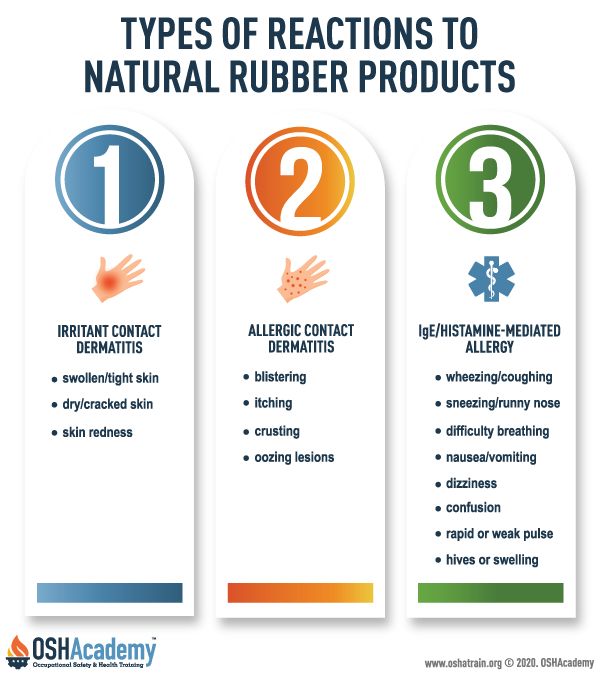 Types of allergic reactions