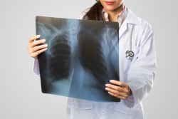 doctor holding x-ray that contains glutaraldhyde