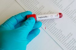 Blood sample being tested for illness