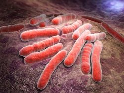 Picture of enlarged tuberculosis batcerial infection