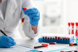 lab employee wearing gloves looking at blood sample