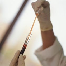 Healthcare provider stirring blood in tube