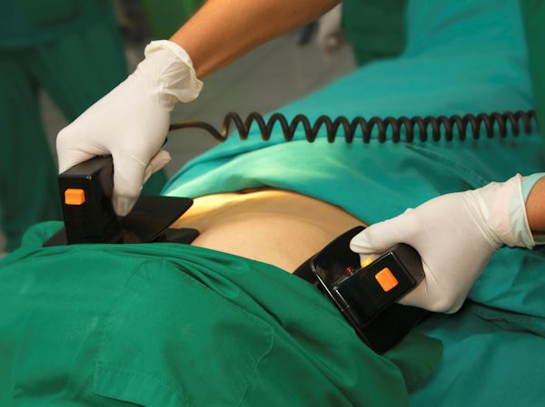 Doctor placing AED handles on a patient that needs to have their heart shocked.
