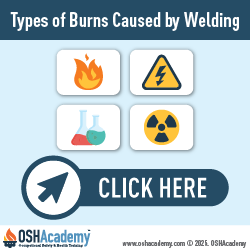 Geigle Safety Group Infographic Burns Caused by Welding